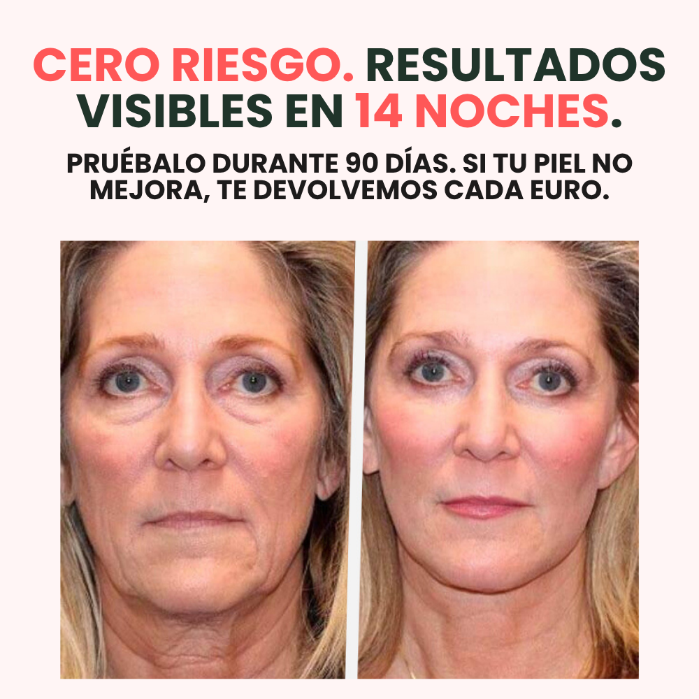 AURAVELLE™ – Bálsamo Regenerador Nocturno (Pack 2x1 · 2 meses de tratamiento)