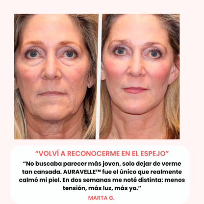 AURAVELLE™ – Bálsamo Regenerador Nocturno (Pack 2x1 · 2 meses de tratamiento)