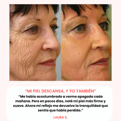 AURAVELLE™ – Bálsamo Regenerador Nocturno (Pack 2x1 · 2 meses de tratamiento)